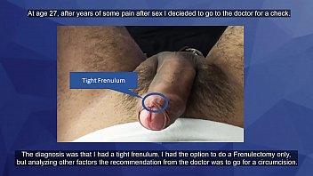 Circumcision?? Check this out.